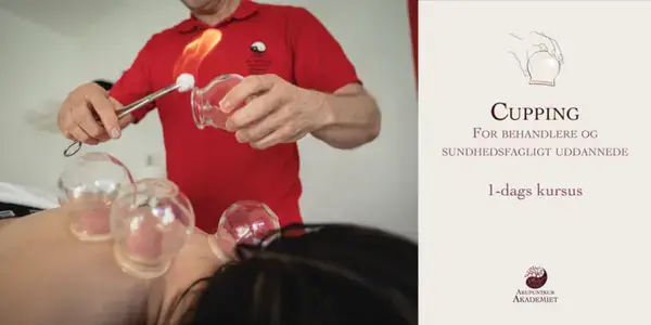 Kursus i CuppingTerapi